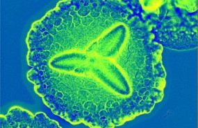 ep aggregatibacter actinomycetemcomitans a menudo vive pacificamente en la boca hasta que las