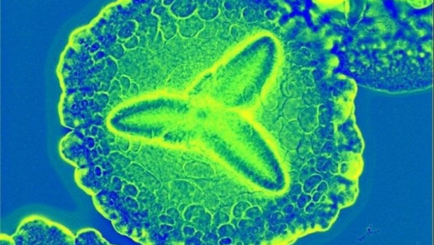 ep aggregatibacter actinomycetemcomitans a menudo vive pacificamente en la boca hasta que las