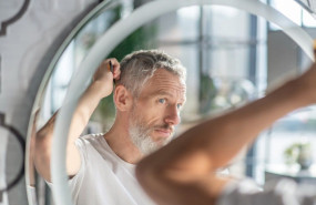 imagen hombre perdida cabello