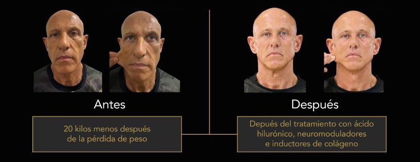 antres y depues aaclinic antres y depues aaclinic