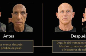 antres y depues aaclinic antres y depues aaclinic