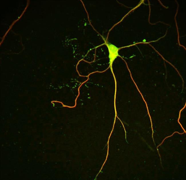 Microtúbulos de una neurona | IRB BARCELONA ep microtubulosuna neurona