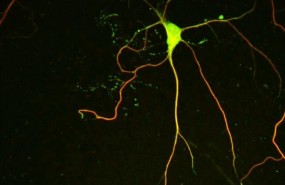 ep microtubulosuna neurona