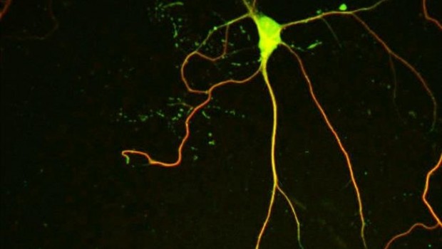 ep microtubulosuna neurona
