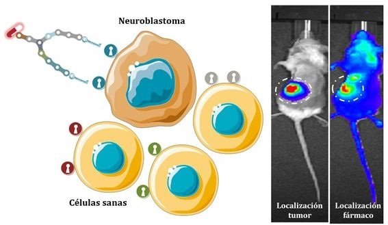 ep neuroblastoma