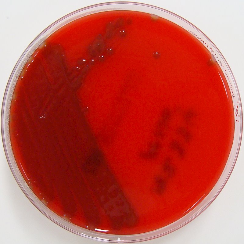 ep meningitis
