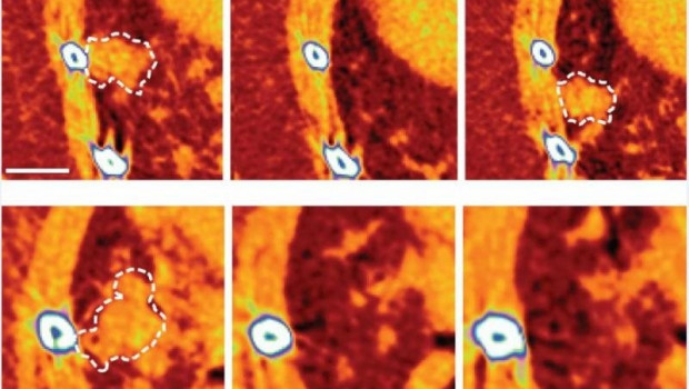 ep imagenes que muestran un tumor pulmonar de raton que recae despues de la terapia dirigida arriba