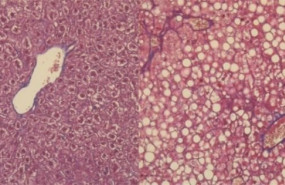ep celulas hepaticas bajo microscopia