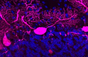 ep cuando el sistema que transporta las moleculas a traves de las largas ramas de las neuronas