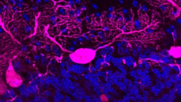 ep cuando el sistema que transporta las moleculas a traves de las largas ramas de las neuronas
