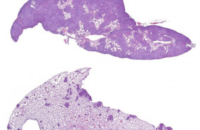 ep la imagen superior muestra tumores pulmonares morados oscuros en ratonesgrupocontrolcomparacionloscarecencrtc2 inferior losugierepotencial terapeuticolos farmacospueden interferircrebcrtc2
