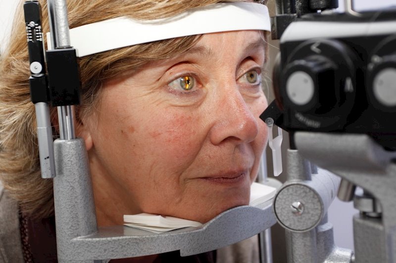 ep revision de degeneracion macular asociada a la edad dmae