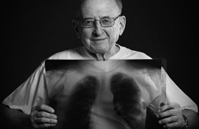 ep tuberculosis 20170323181102