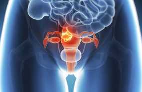 1626350223 cancer utero