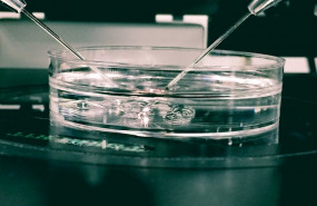 ep fecundacion in vitro 20200218164512