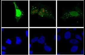 ep la replicacion del virus de la hepatitis d rojo induce autofagia verde en la celula huesped