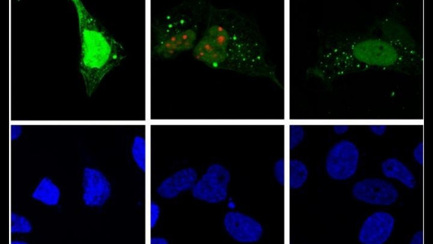 ep la replicacion del virus de la hepatitis d rojo induce autofagia verde en la celula huesped