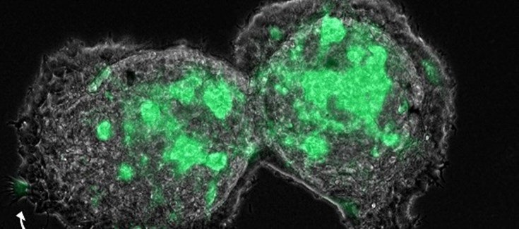 ep los fibroblastos asociados con el cancer caf actuan como lideres de la invasion colectiva de las