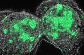 ep los fibroblastos asociados con el cancer caf actuan como lideres de la invasion colectiva de las