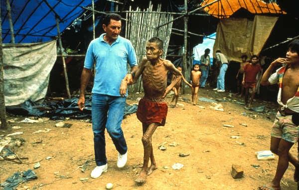 Un indígena yanomami afectado por el sarampión | SURVIVAL INTERNATIONAL ep un indigena yanomami afectadosarampion