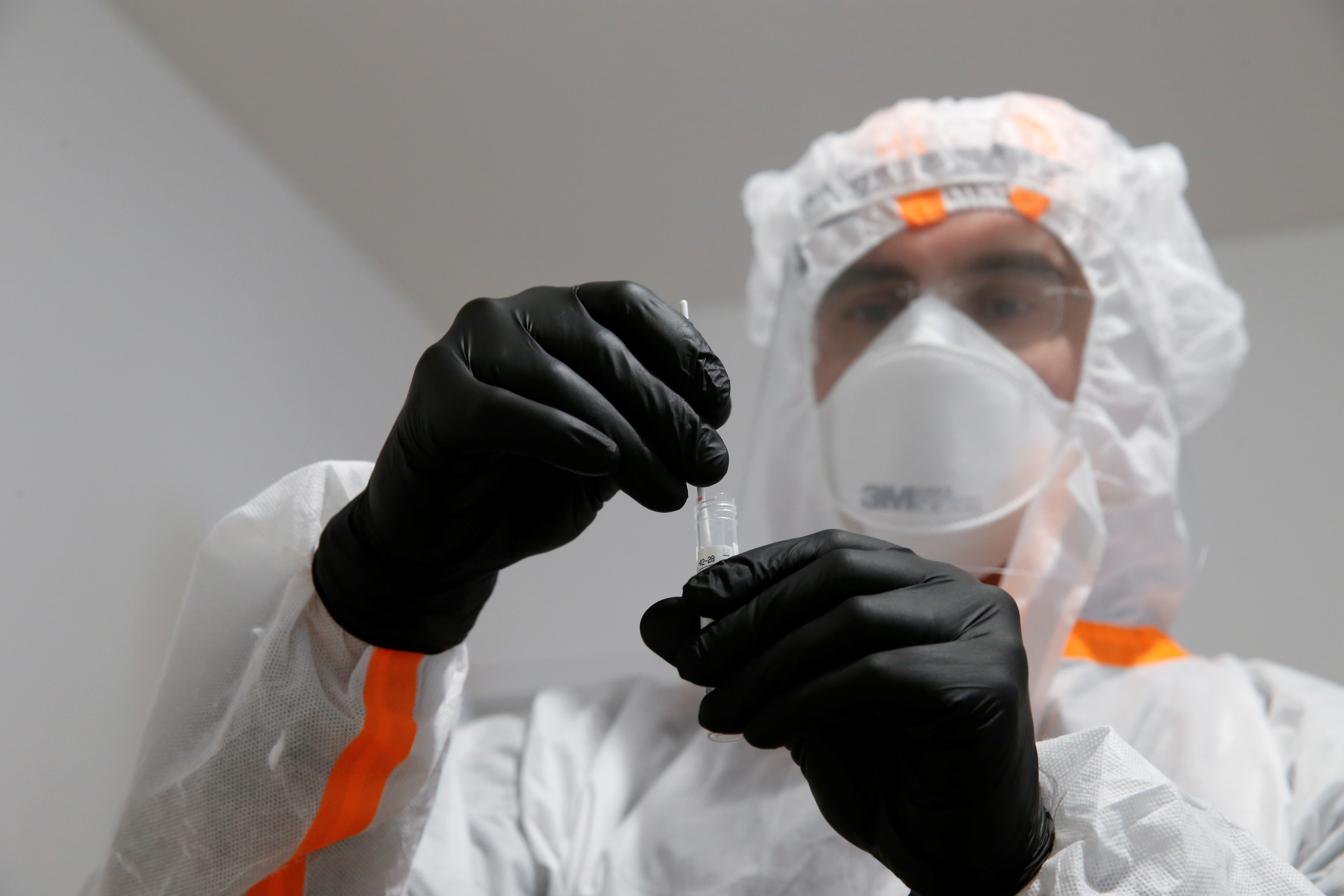 coronavirus-des-biologistes-s-interrogent-sur-la-strategie-de-depistage coronavirus-des-biologistes-s-interrogent-sur-la-strategie-de-depistage