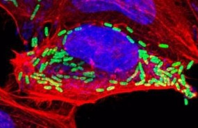 ep la bacteria shigella puede anular la muerte celular programada estableciendo asi un nicho para