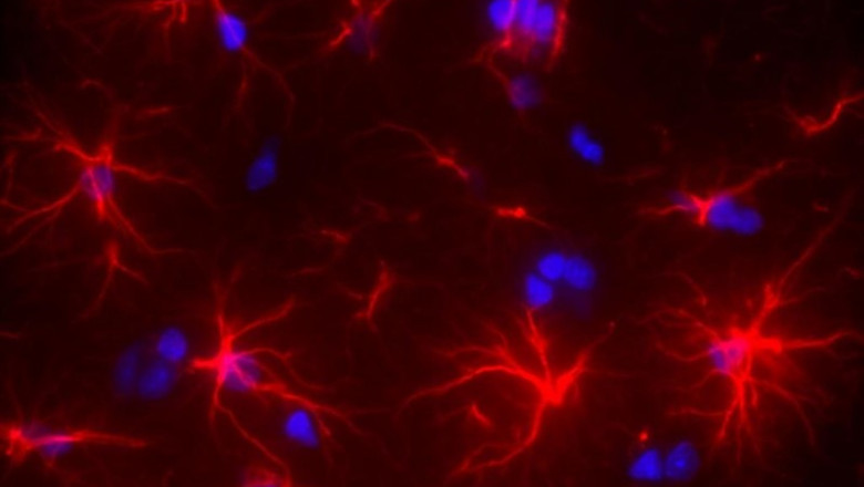 Cuatro semanas después de la aparición de la enfermedad hepática, las células astrocíticas (rojas) en los cerebros de las ratas enfermas muestran una morfología alterada con acortamiento y reducción en el número de sus extensiones | KATARZYNA PIERZCHALA ET DARIO SESSA ep cuatro semanas despues de la aparicion de la enfermedad hepatica las celulas astrociticas rojas