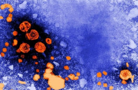 ep hepatitis b 20190726125504