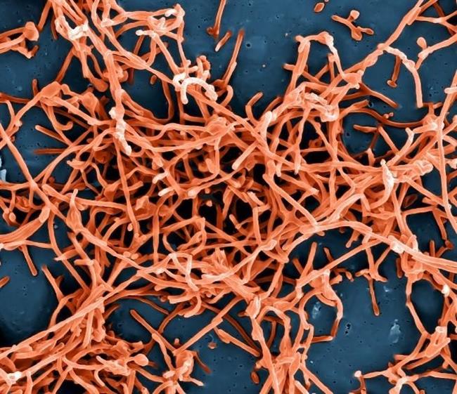 Partículas del virus ébola | NIAID/FLICKR - Archivo ep particulasvirus ebola