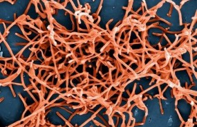 ep particulasvirus ebola