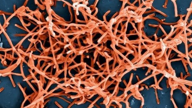 ep particulasvirus ebola