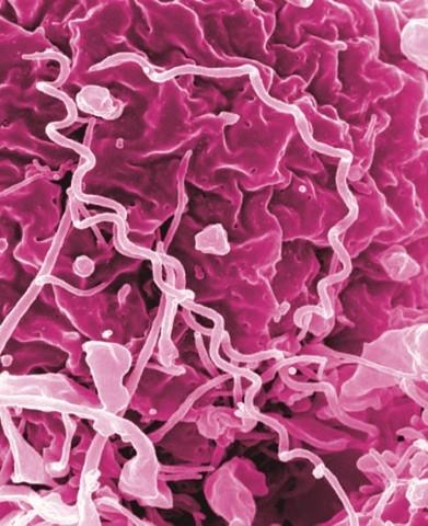 ep treponema pallidum bacteriala sifilis