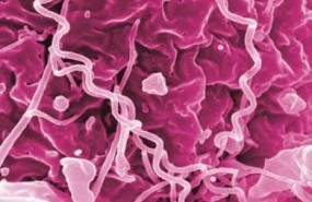ep treponema pallidum bacteriala sifilis
