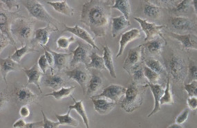 ep celulas de adenocarcinoma de pulmon humano utilizadas en el estudio