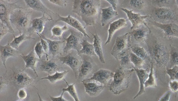 ep celulas de adenocarcinoma de pulmon humano utilizadas en el estudio