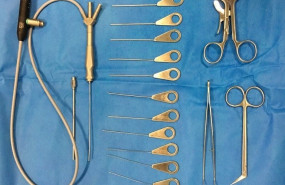 ep sialoendoscopia