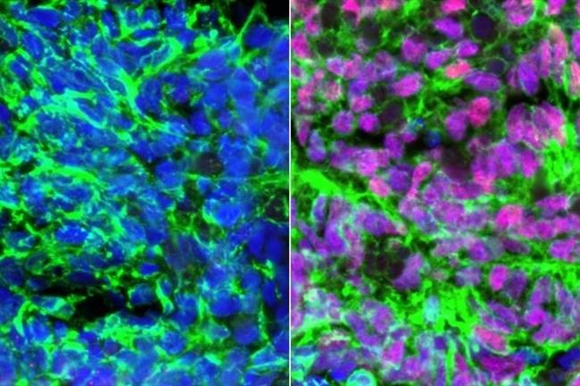 Células madre que pasan a ser interneuronas sensoriales | UCLA ep celulas madrepasanser interneuronas sensoriales