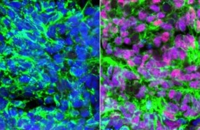 ep celulas madrepasanser interneuronas sensoriales