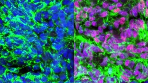 ep celulas madrepasanser interneuronas sensoriales