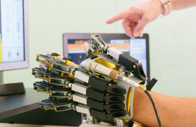 1 neurorrehabilitacion y parkinson 1 