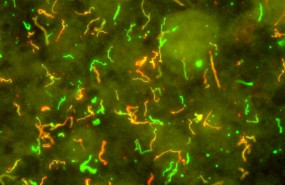 ep borrelia burgdorferi patogeno causantela enfermedadlyme