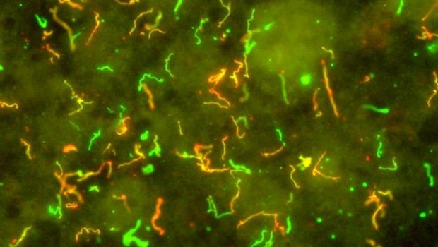 ep borrelia burgdorferi patogeno causantela enfermedadlyme