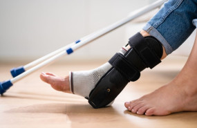 2 ndp   esguince de tobillo mal curado