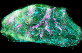 ep la luz condensada viajando de extremo a extremo en un cerebro humano hecho transparente