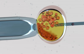 1584531108 margenfoto