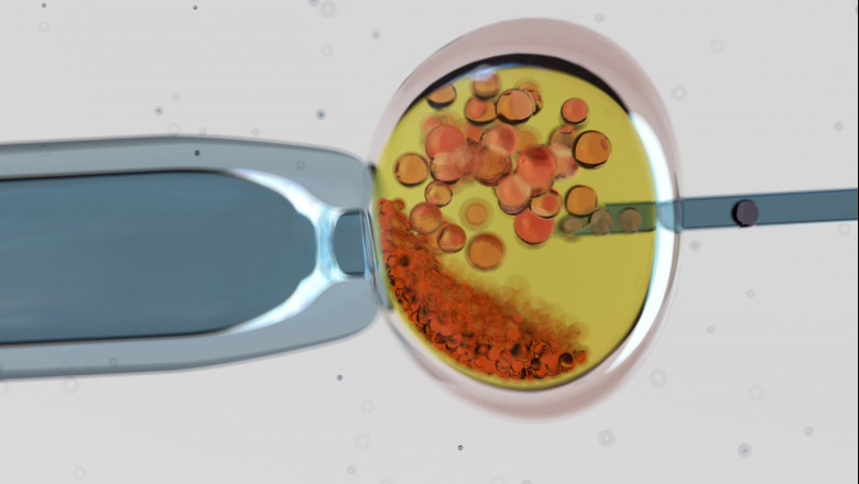 1584531108 margenfoto