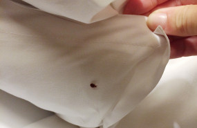 chinche en la cama chinche en la cama