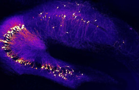 ep neuronas en el hipocampo una region del cerebro clave para el aprendizaje y la memoria que ya