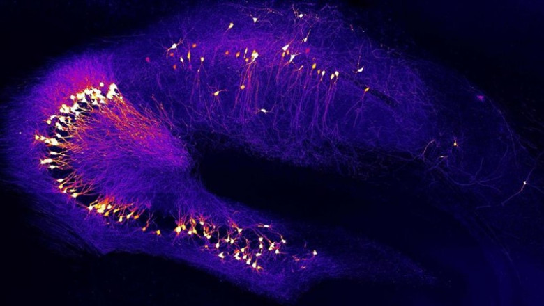 Neuronas en el hipocampo, una región del cerebro clave para el aprendizaje y la memoria, que ya está dañada en las primeras etapas de la enfermedad de Alzheimer. | Y. ZHANG UND A. KONNERTH / TUM - Archivo ep neuronas en el hipocampo una region del cerebro clave para el aprendizaje y la memoria que ya