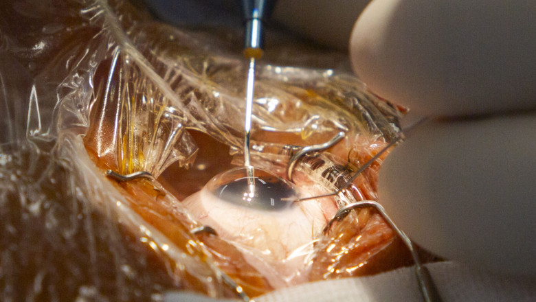  t8b0306 20260216175347 